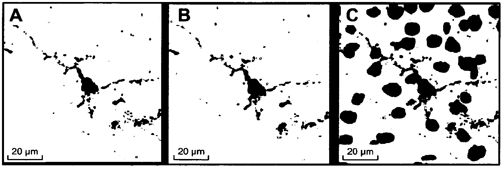 Use of an anti-tau ps422 antibody for the treatment of brain diseases