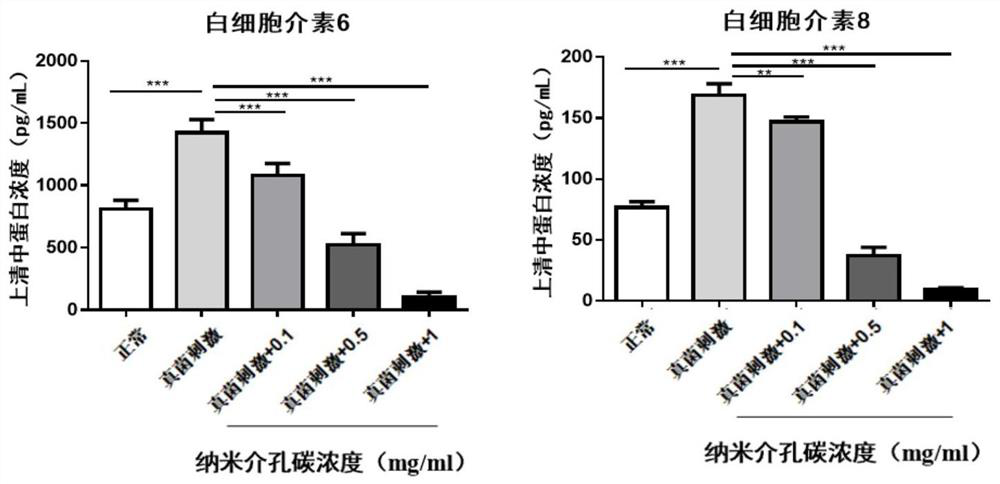 Nanometer mesoporous carbon eye drops loaded with natamycin and silver as well as preparation method and application thereof