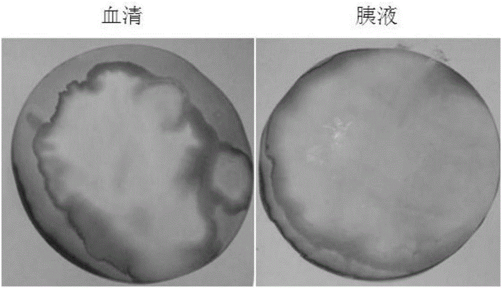 Pancreatic leakage detection agent based on divalent cobalt ions and application of pancreatic leakage detection agent