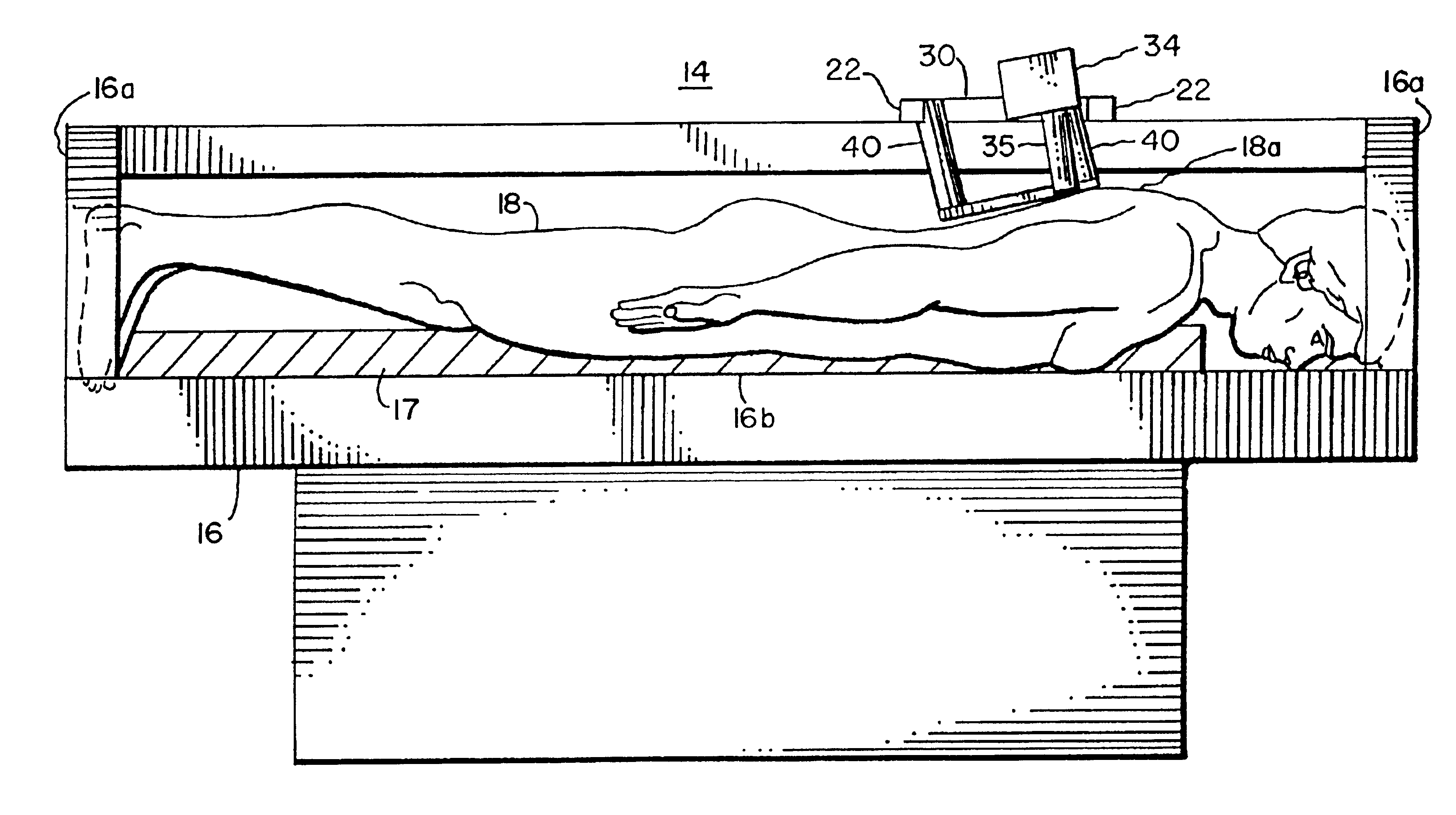 System for confocal imaging within dermal tissue