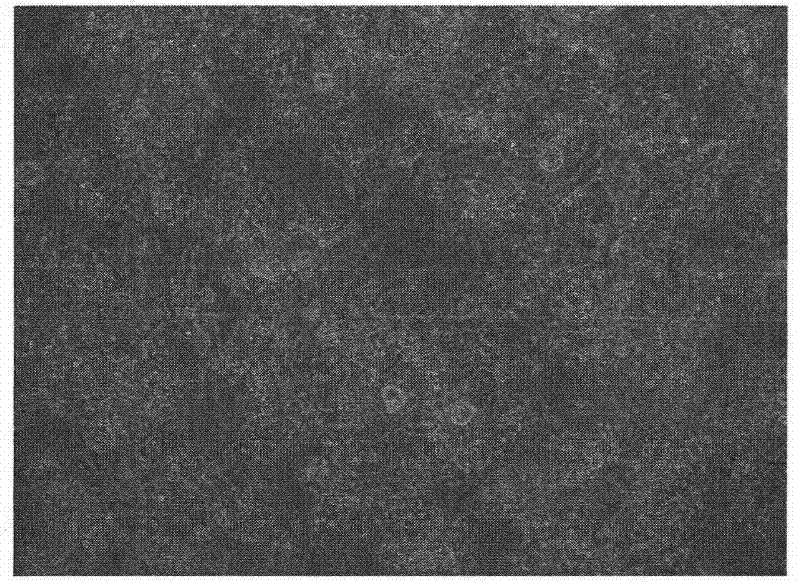 Method for separating and purifying oligodendrocyte precursor cells