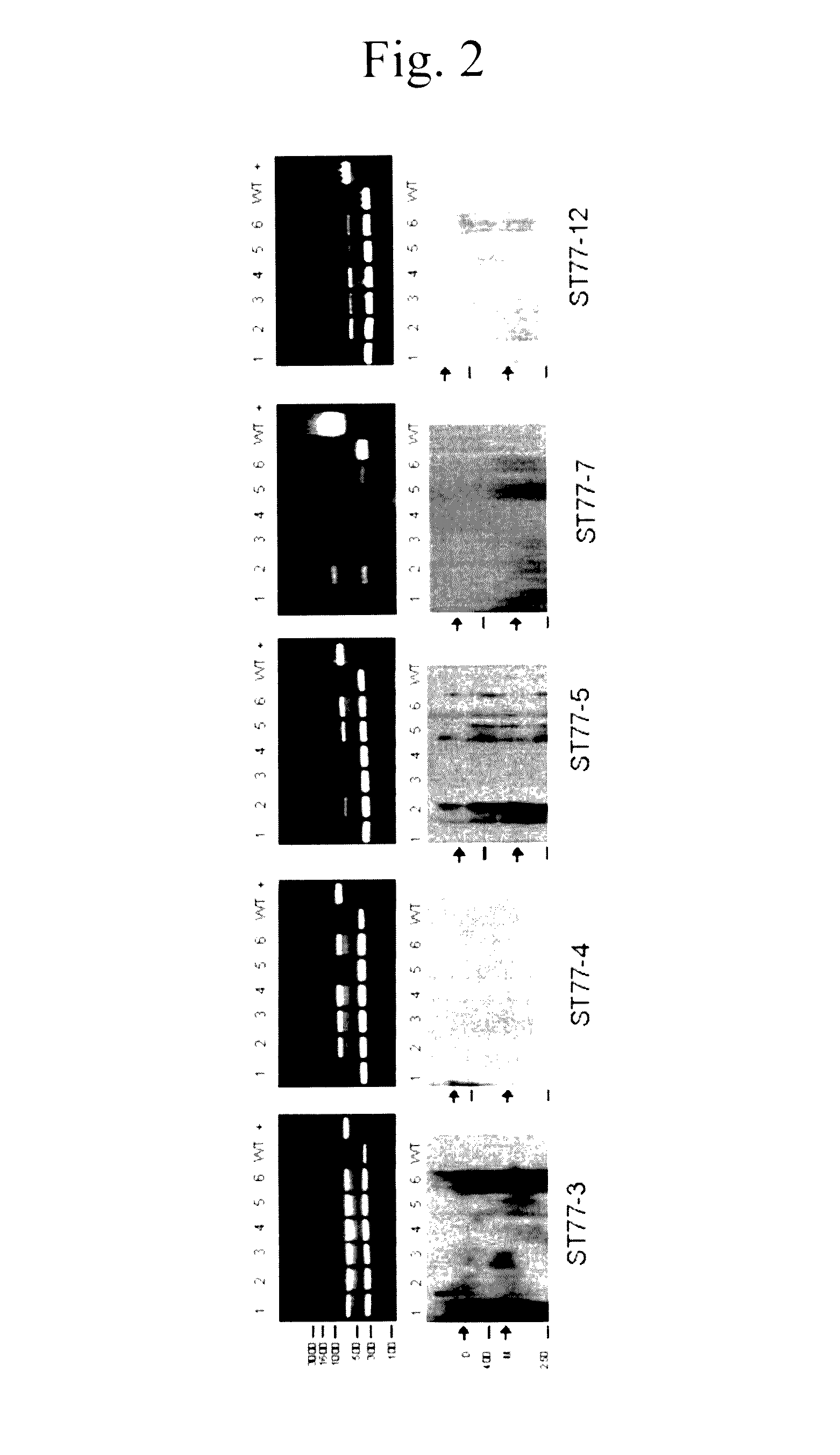 Immunoassay for detecting thyroglobulin utilizing soybean produced recombinant thyroglobulin