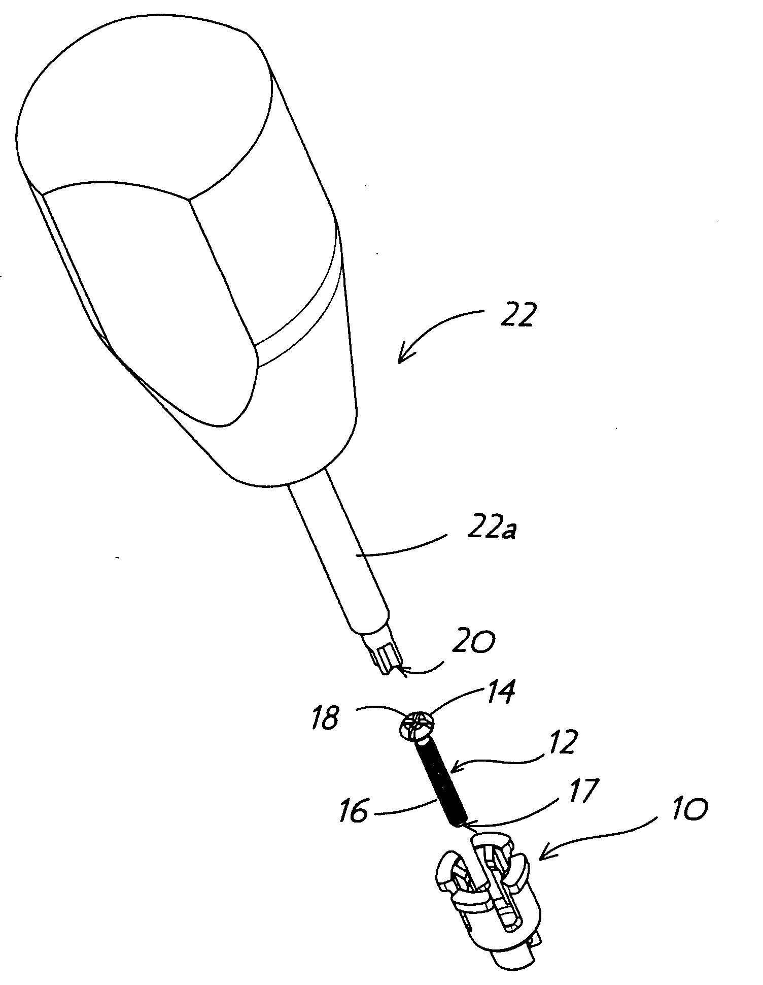 Surgical screw retention clip and method of using the same