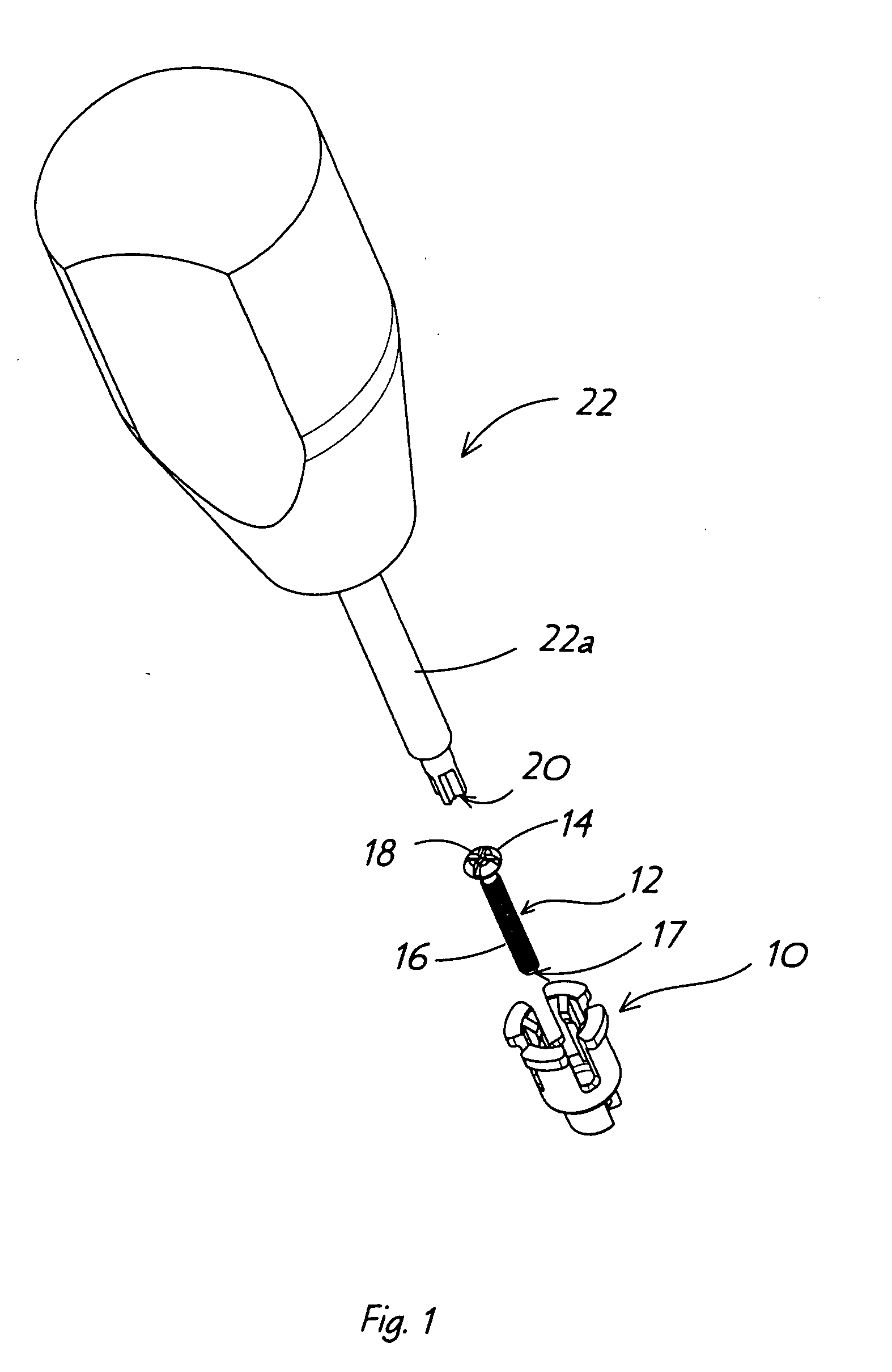 Surgical screw retention clip and method of using the same