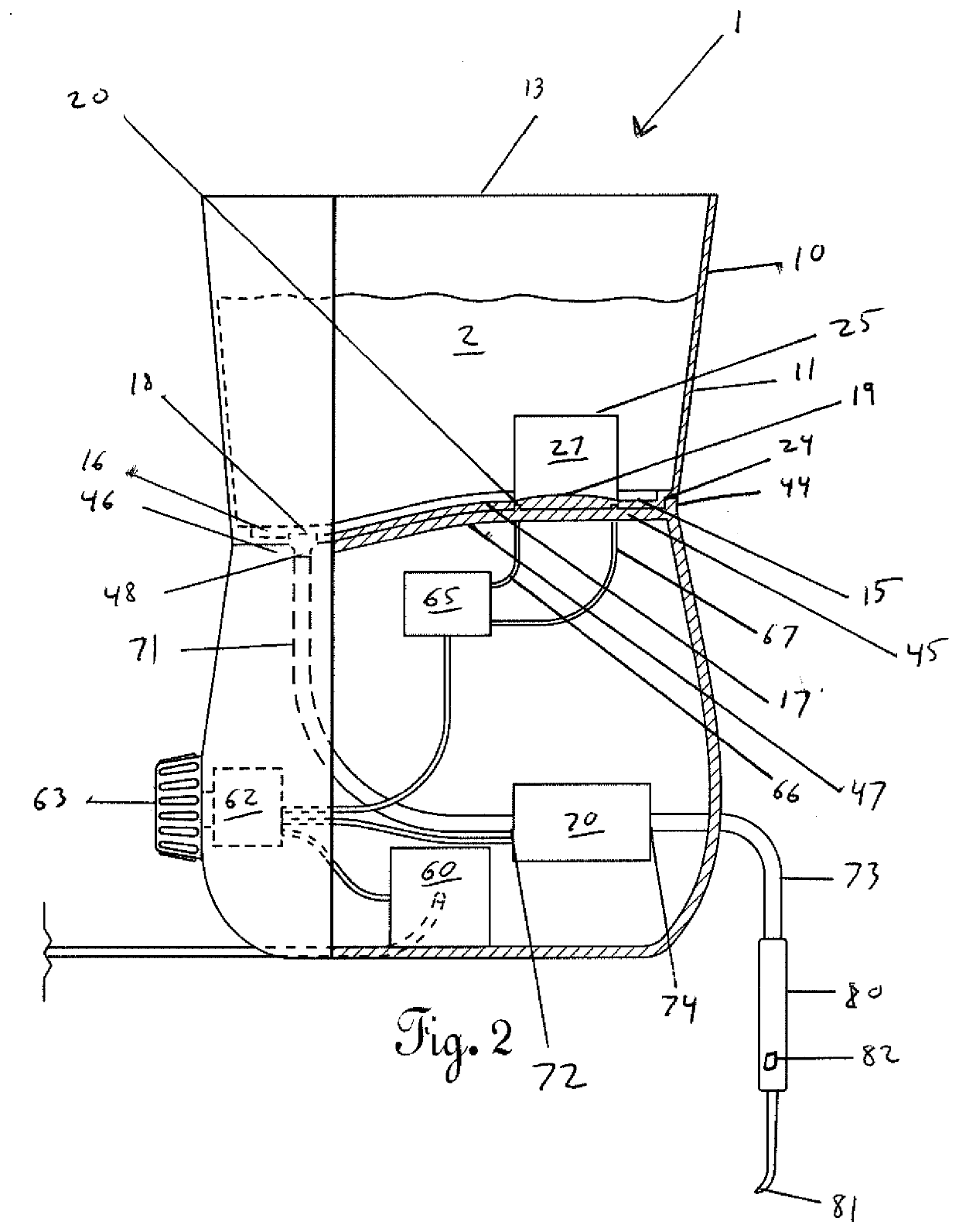 Dental Irrigation Device