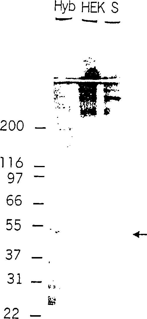 Recombinant human mannan-binding lectin