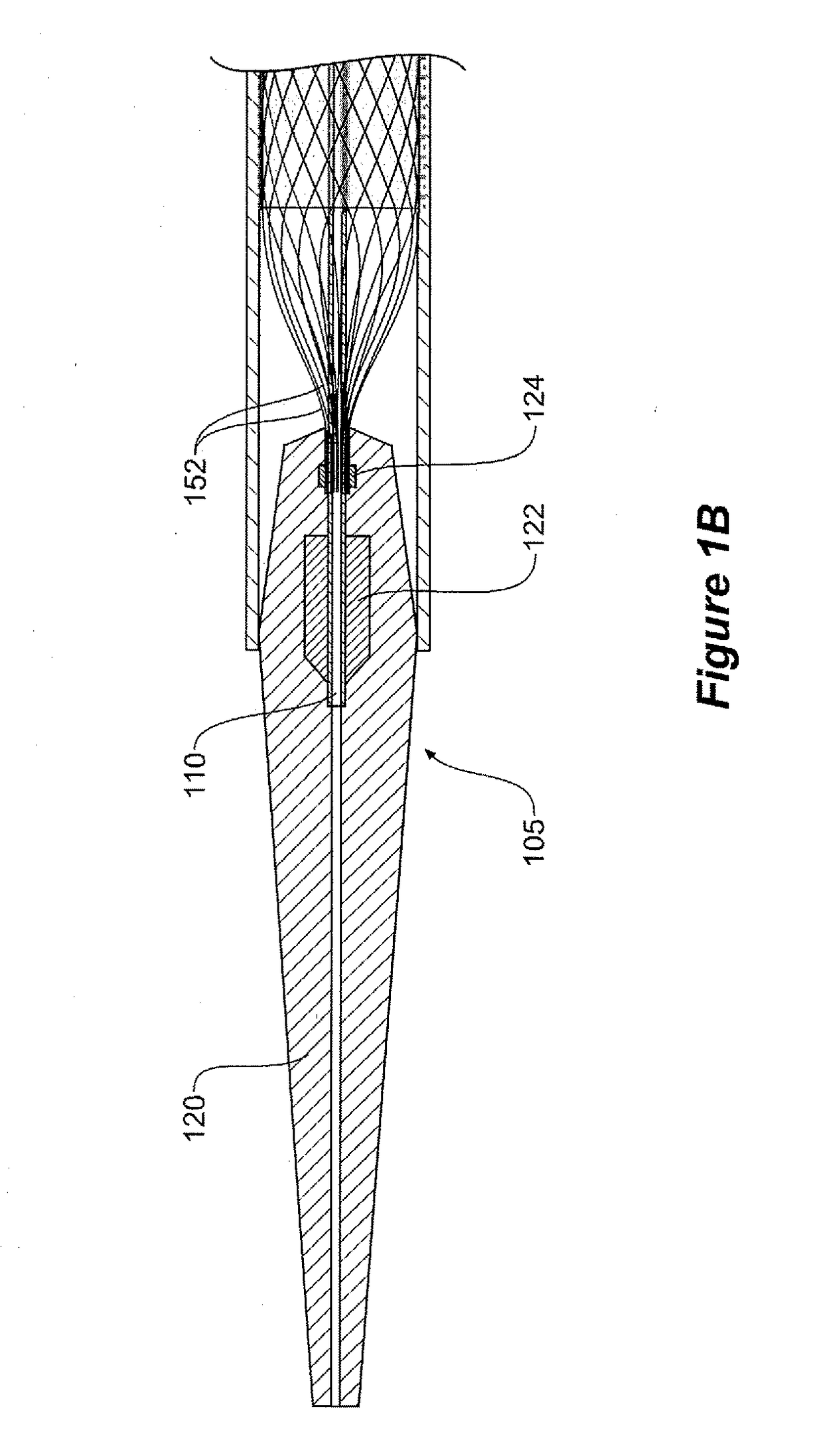 Medical device for temporary deployment into a bodily lumen