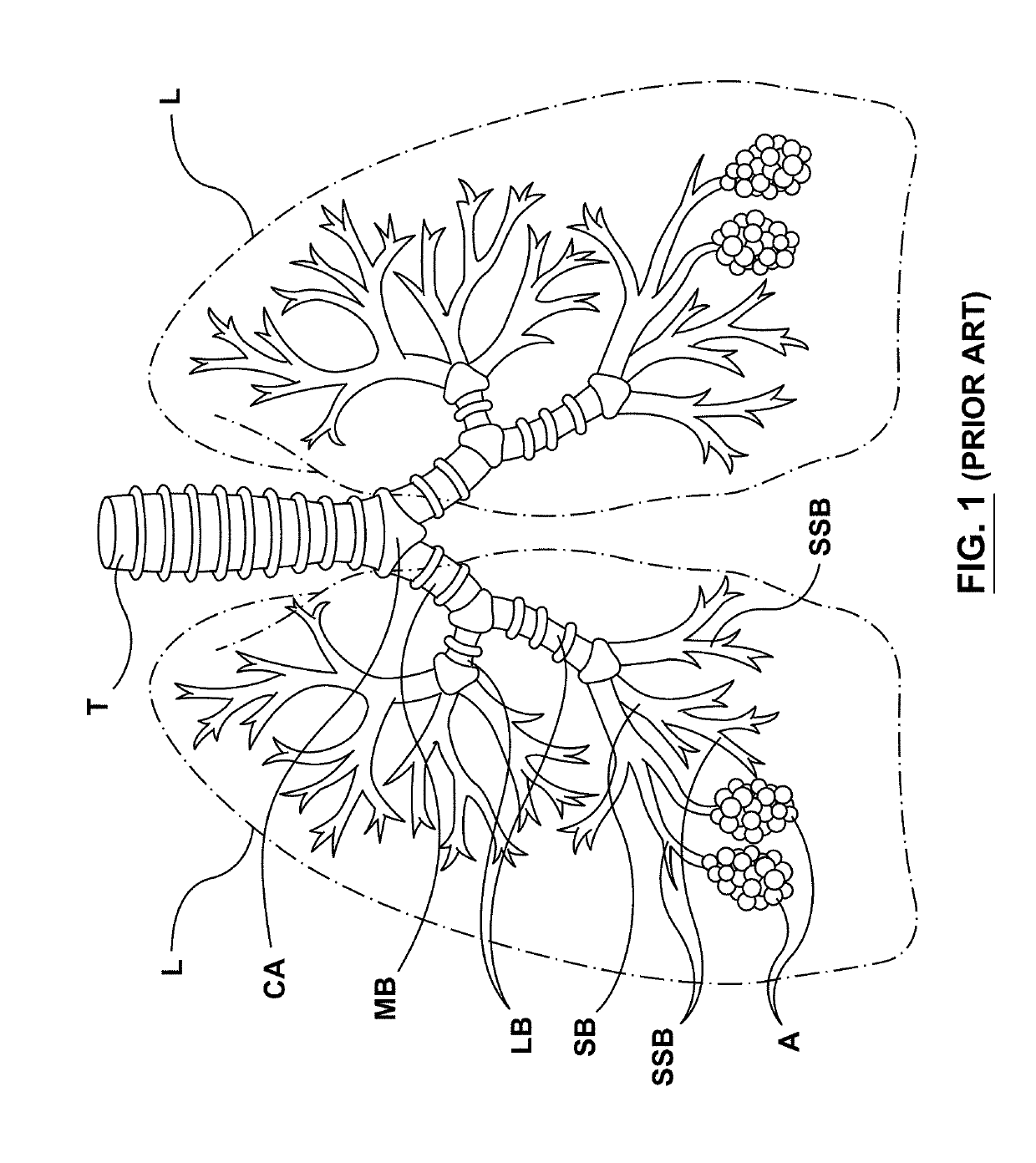 Methods, apparatuses, and systems for the treatment of pulmonary disorders