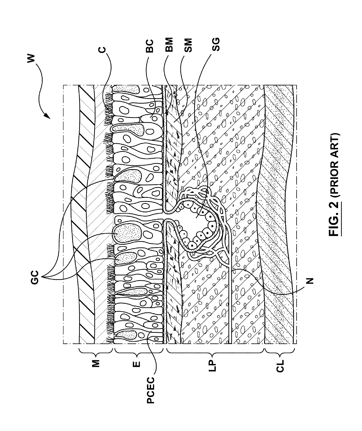 Methods, apparatuses, and systems for the treatment of pulmonary disorders