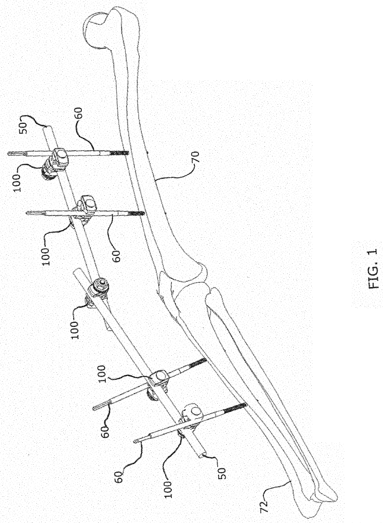 External fixator assembly