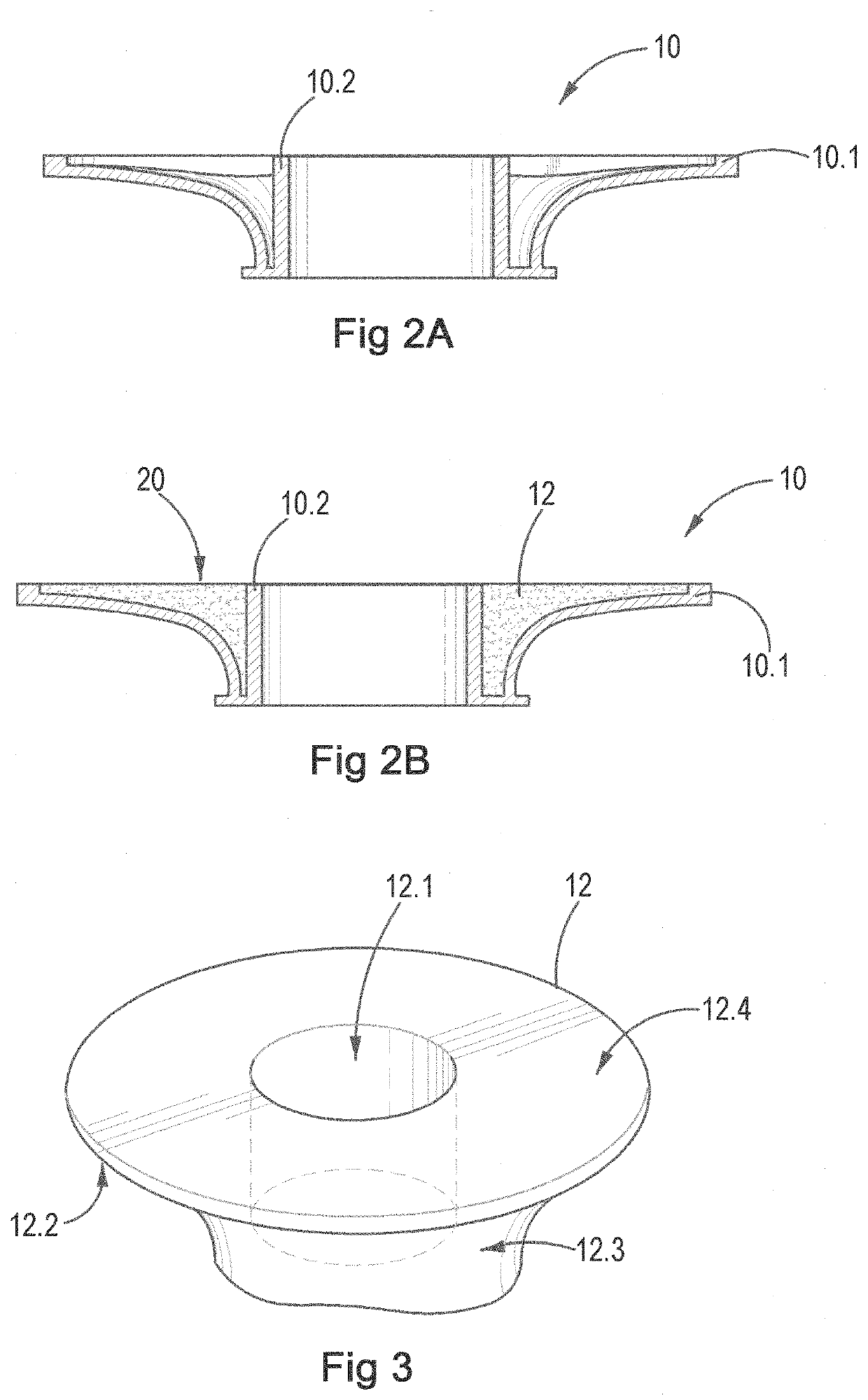 Customisable stoma insert