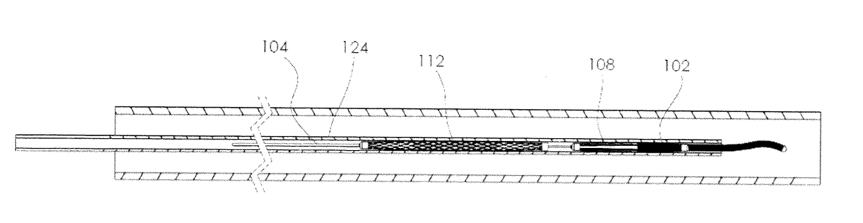 Embolus Removal Device with Blood Flow Restriction and Related Methods