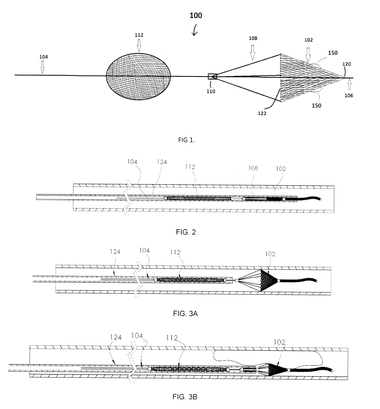 Embolus Removal Device with Blood Flow Restriction and Related Methods