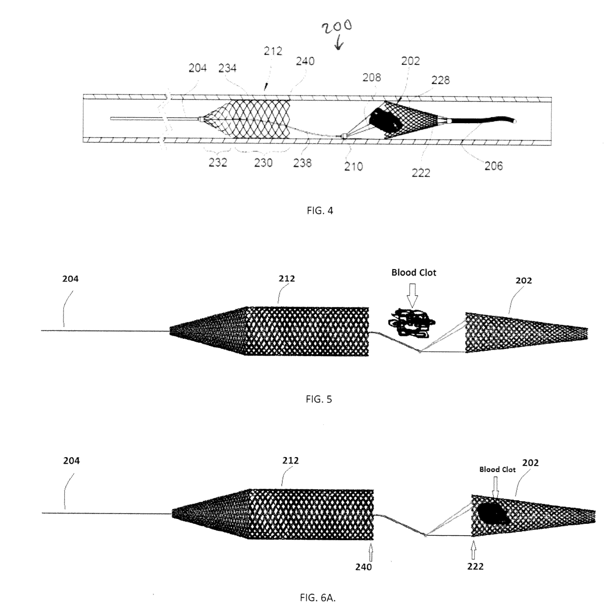 Embolus Removal Device with Blood Flow Restriction and Related Methods