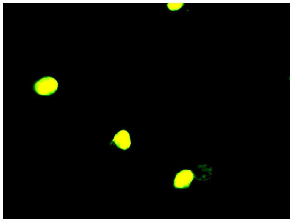 Gynecological fluorescent staining solution as well as preparation method and application thereof