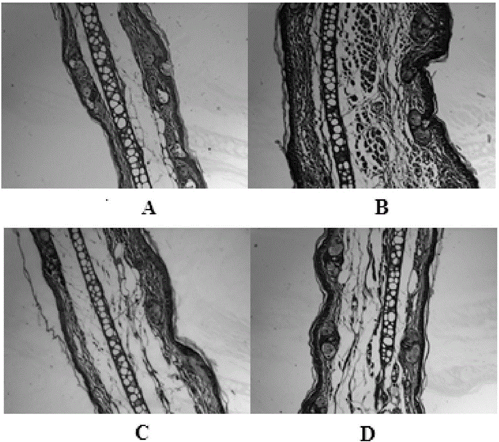 Gel for treating skin diseases such as dermatitis and eczema and preparation method and application of gel for treating skin diseases such as dermatitis and eczema