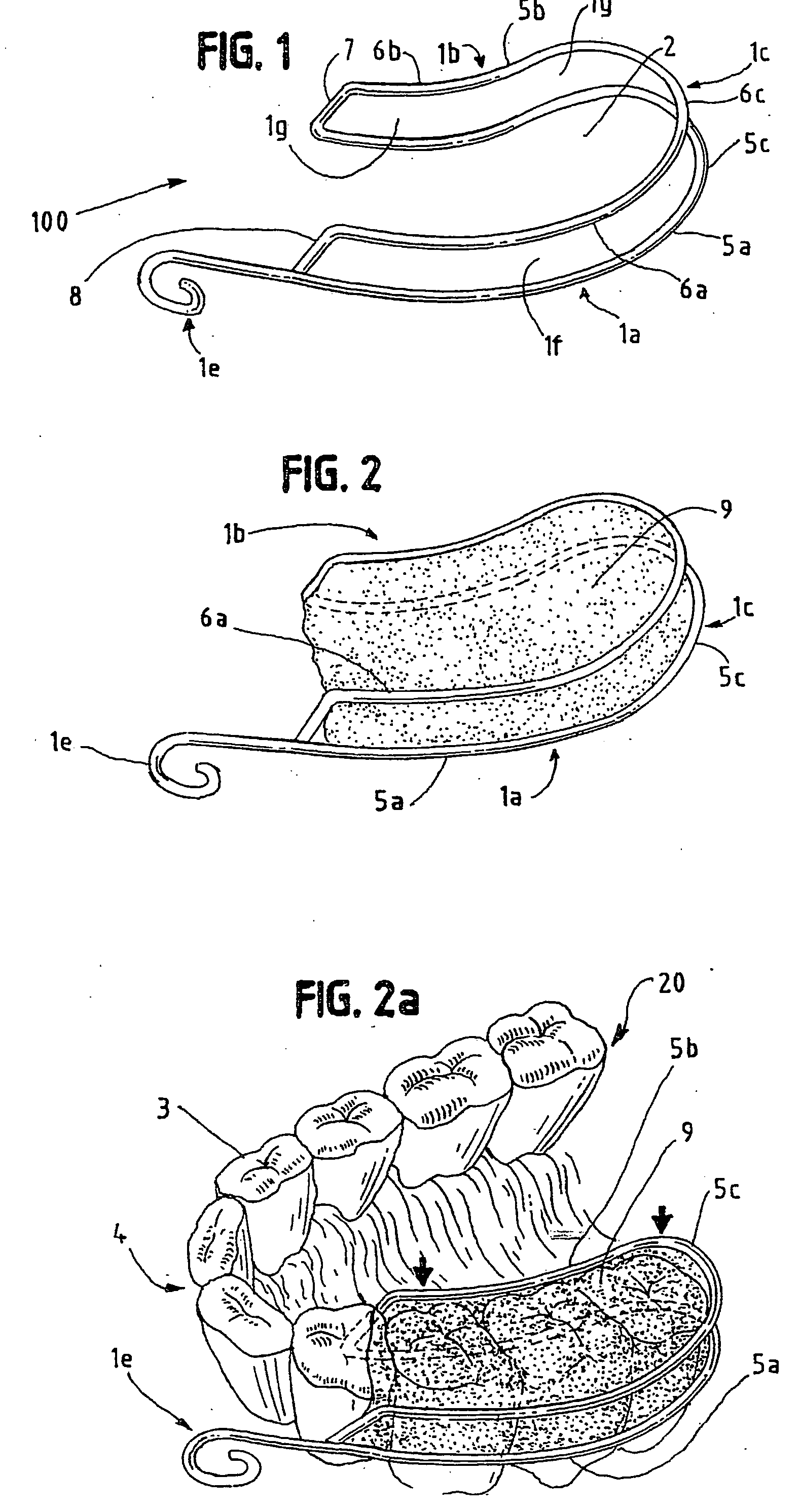 Dental impression method and device