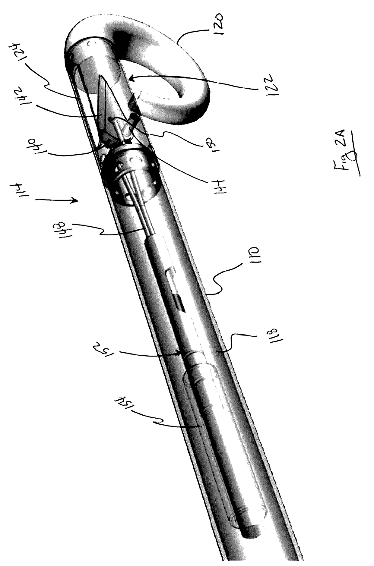 Methods and devices for diastolic assist