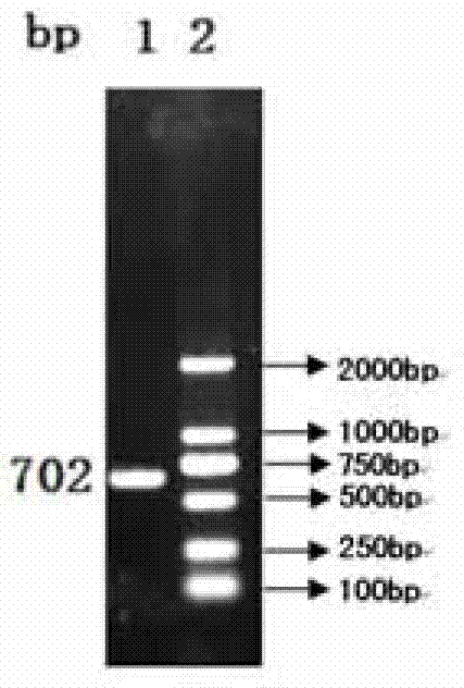 Anti-porcine circovirus and porcine infectious pleuropneumonia vaccine composition and preparation