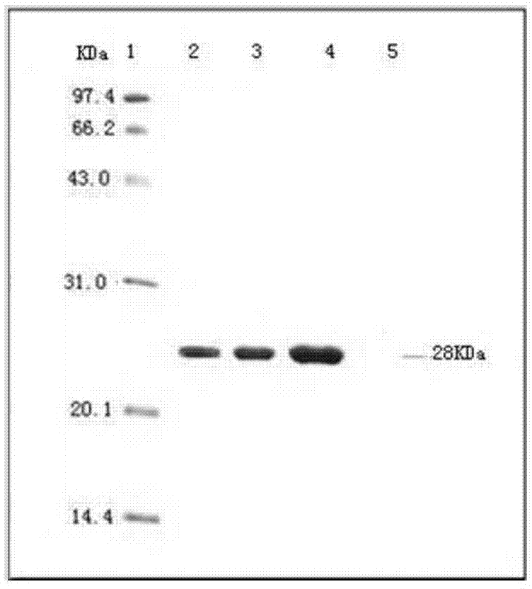 Anti-porcine circovirus and porcine infectious pleuropneumonia vaccine composition and preparation