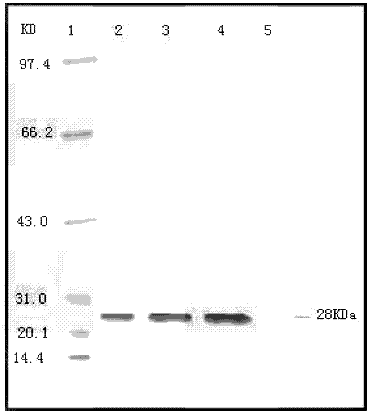 Anti-porcine circovirus and porcine infectious pleuropneumonia vaccine composition and preparation