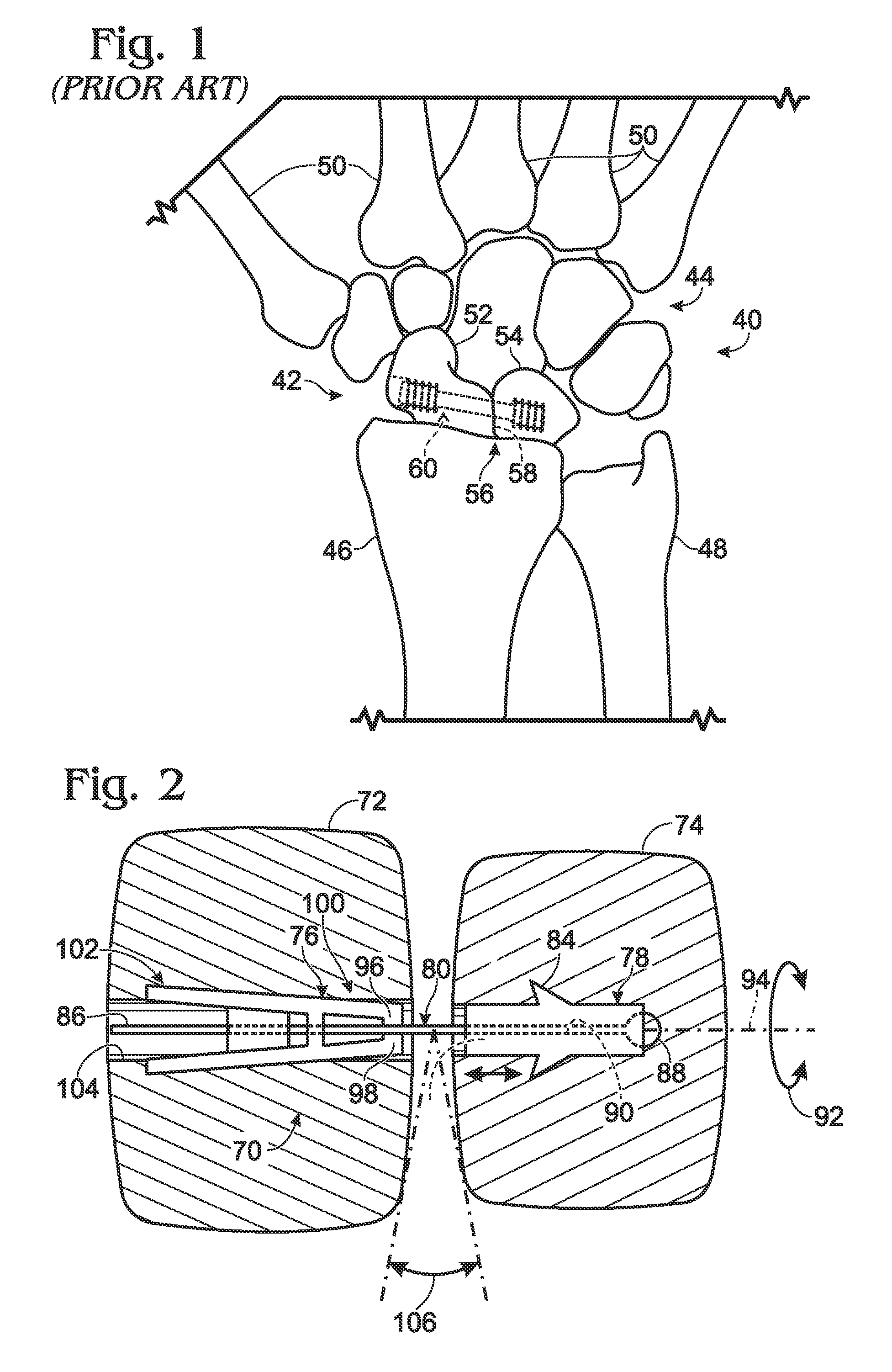 Orthopedic connector system