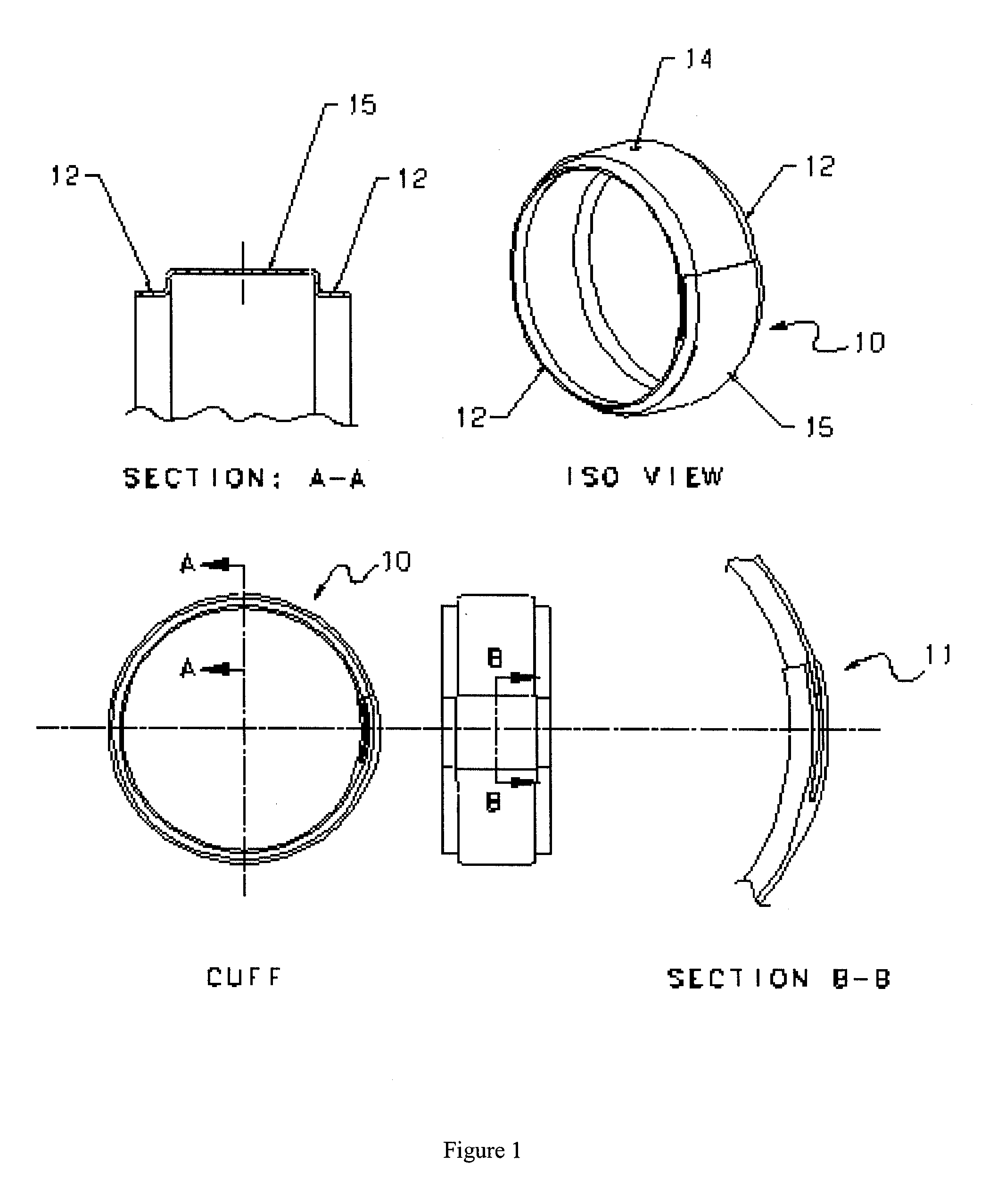 Bleed leak detection system