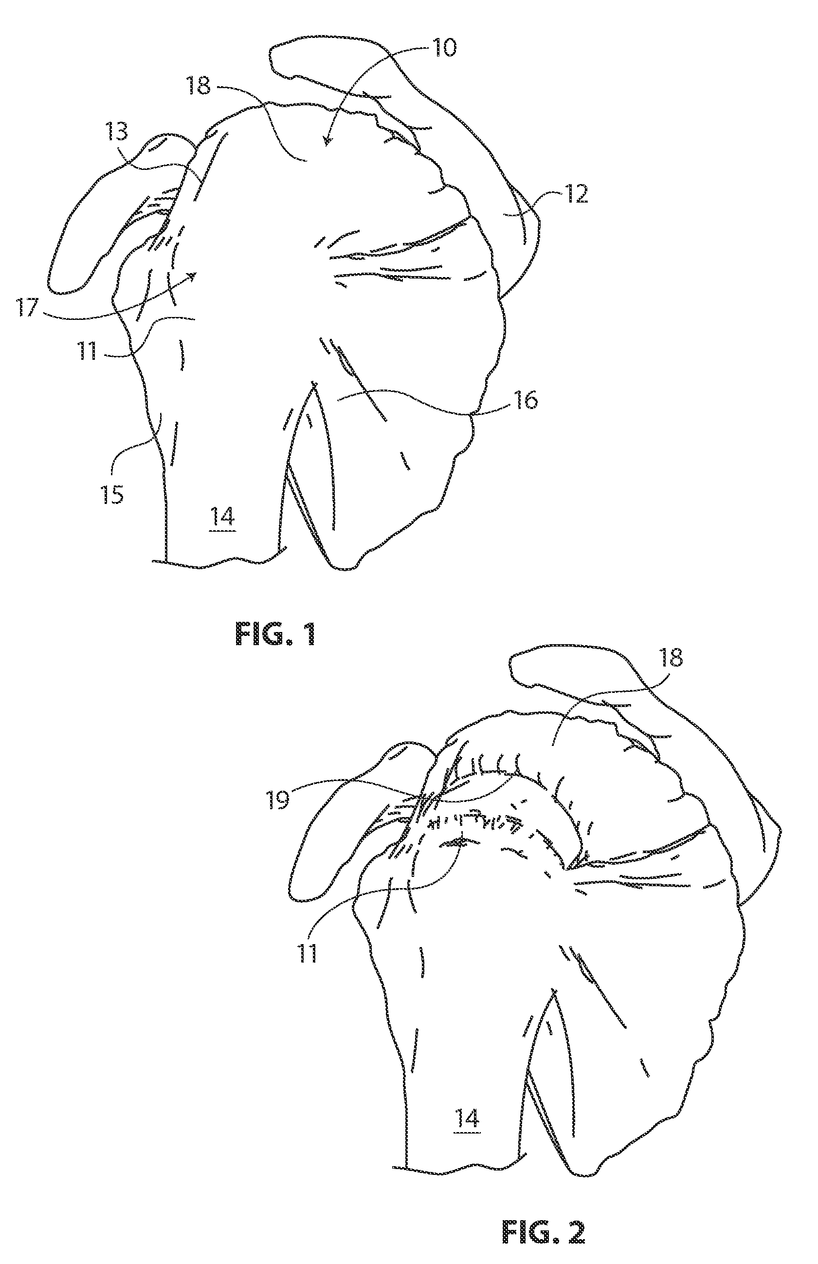 Methods and apparatus for deploying sheet-like materials