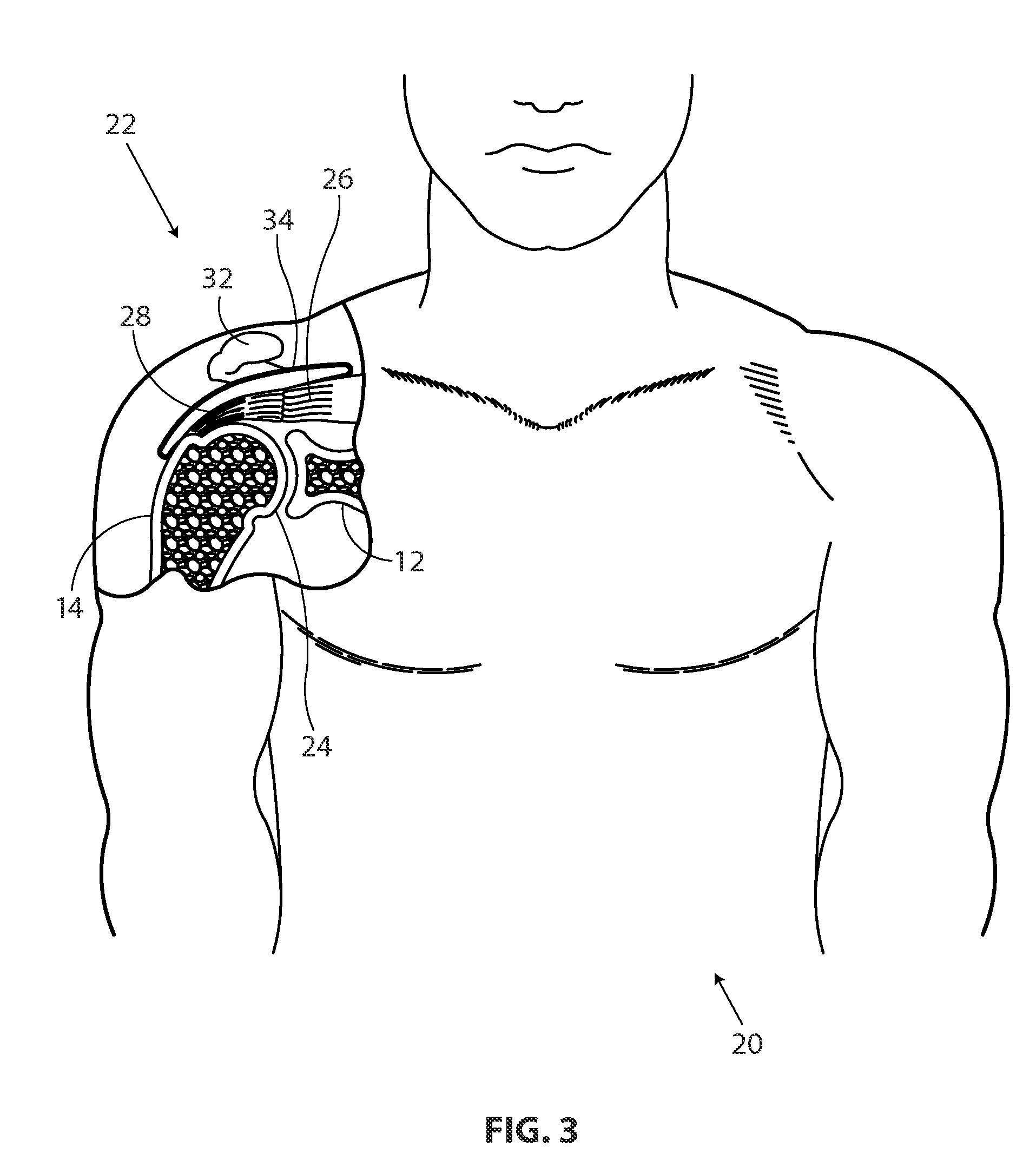 Methods and apparatus for deploying sheet-like materials