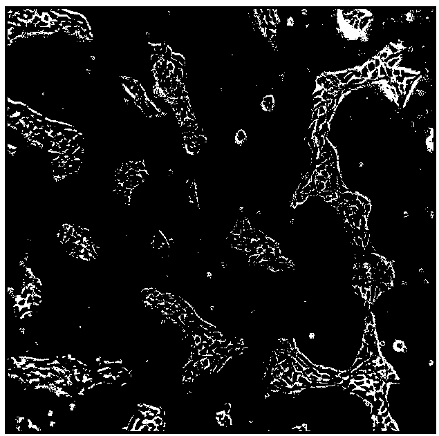 Method for realizing efficient differentiation of induced pluripotent stem cells towards mature endothelial cells