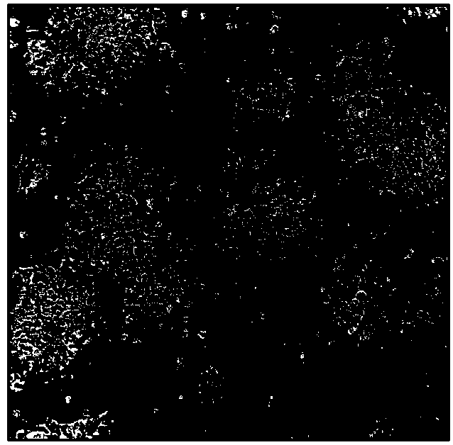 Method for realizing efficient differentiation of induced pluripotent stem cells towards mature endothelial cells