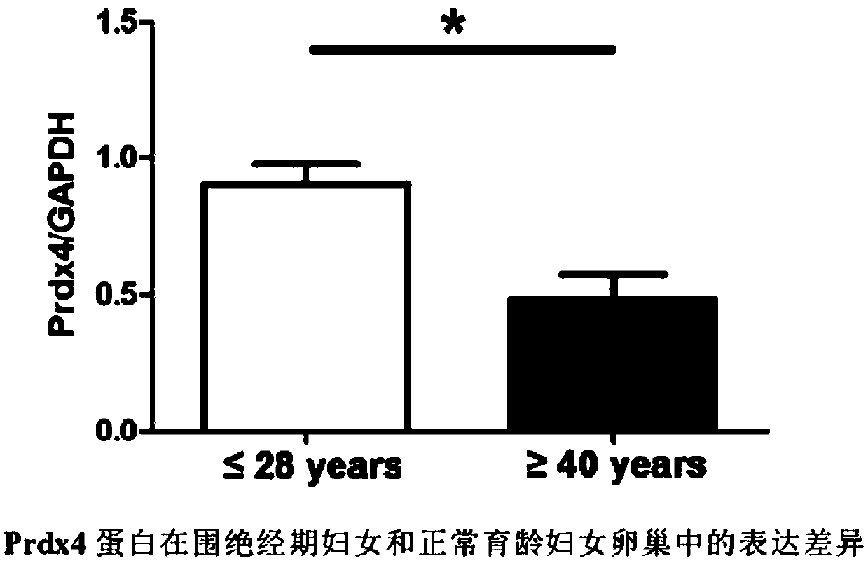 Application of enhancing antioxidation of oocyte cultured in vitro by Peroxiredoxin 4 protein