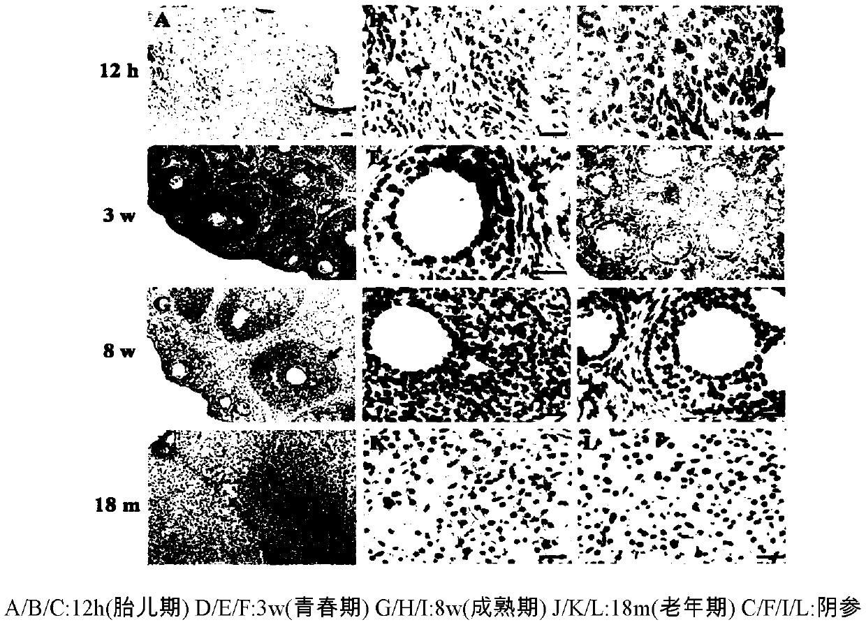 Application of enhancing antioxidation of oocyte cultured in vitro by Peroxiredoxin 4 protein