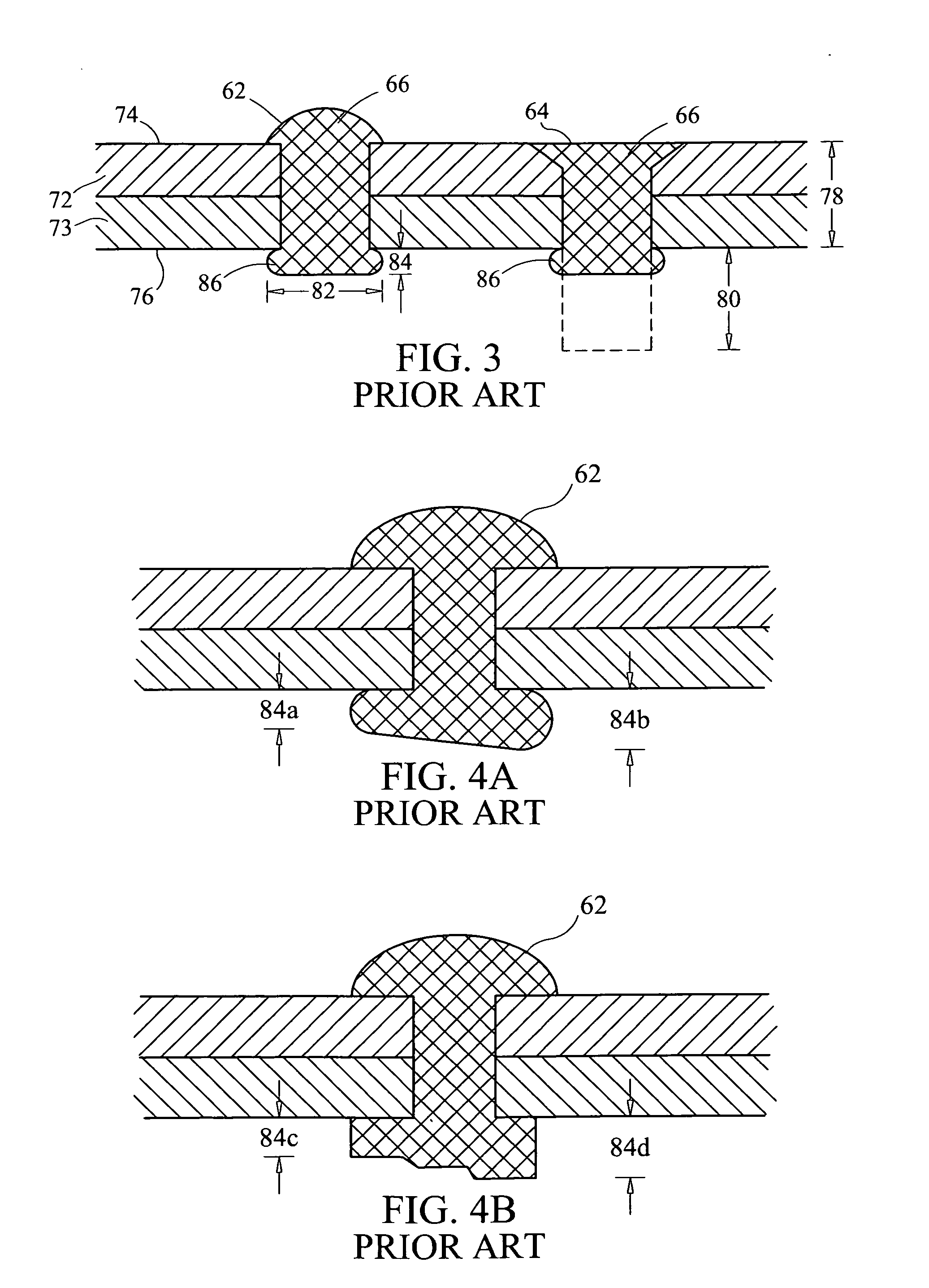 Rivet setting system