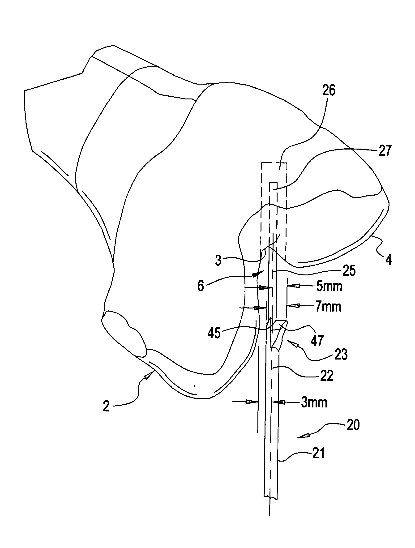 Cannulated drill bit with radially offset cutting edge