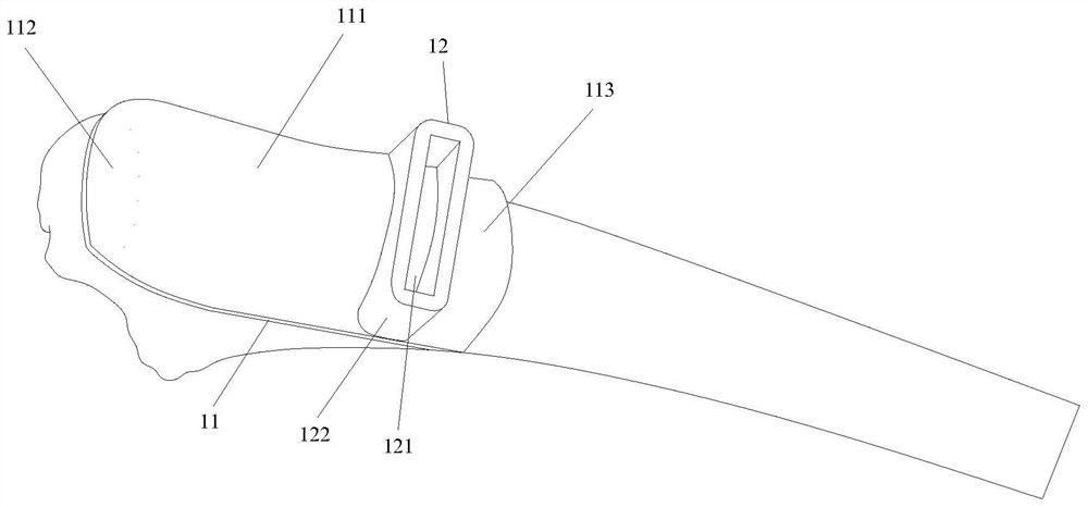 Proximal Ulnar Osteotomy Orthopedic Guide System