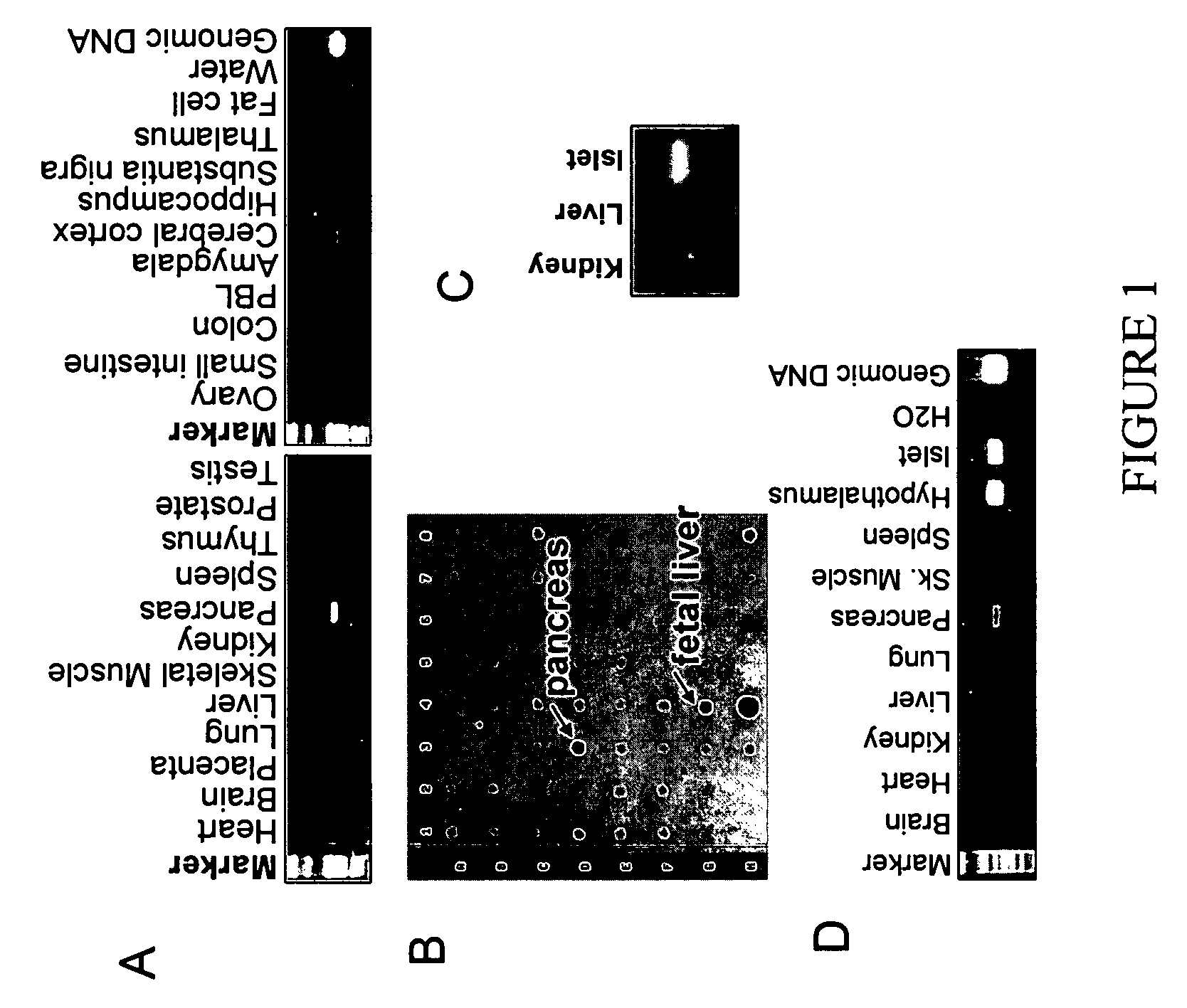 Trisubstituted aryl and heteroaryl derivatives as modulators of metabolism and the prophylaxis and treatment of disorders related thereto