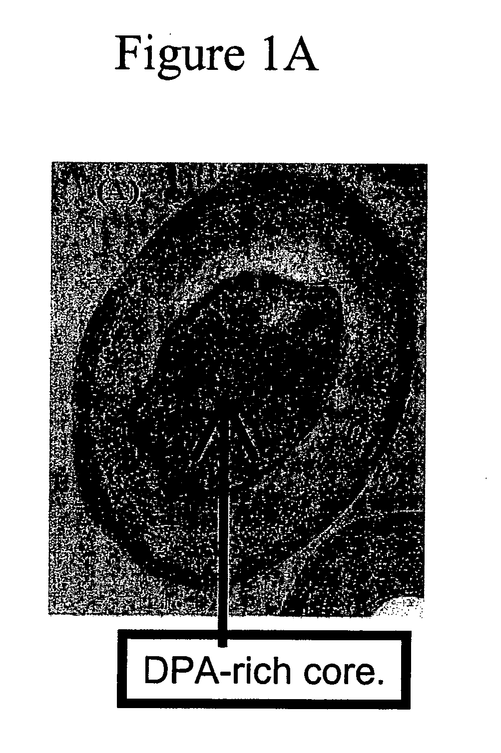 Method and apparatus for detecting and quantifying bacterial spores on a surface