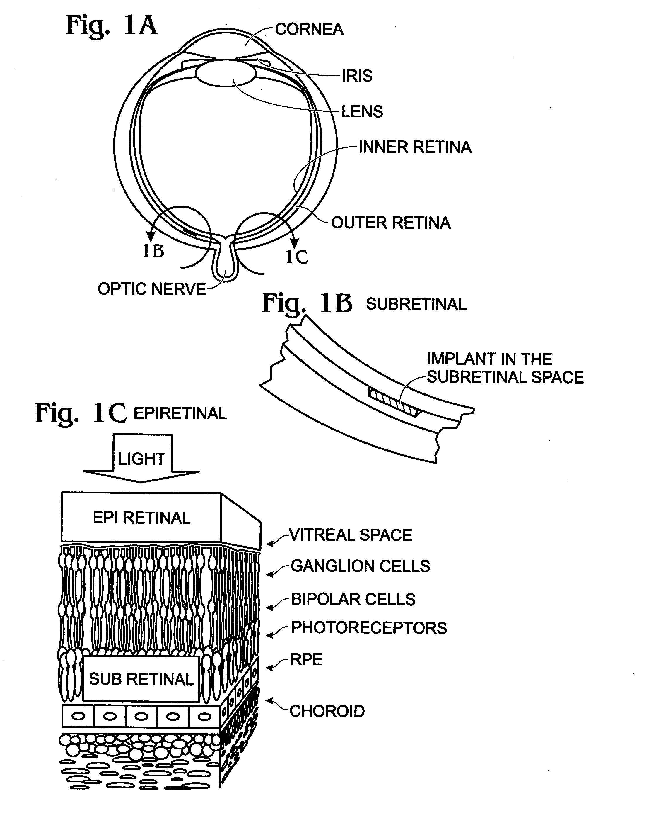 IrOx nanowire neural sensor