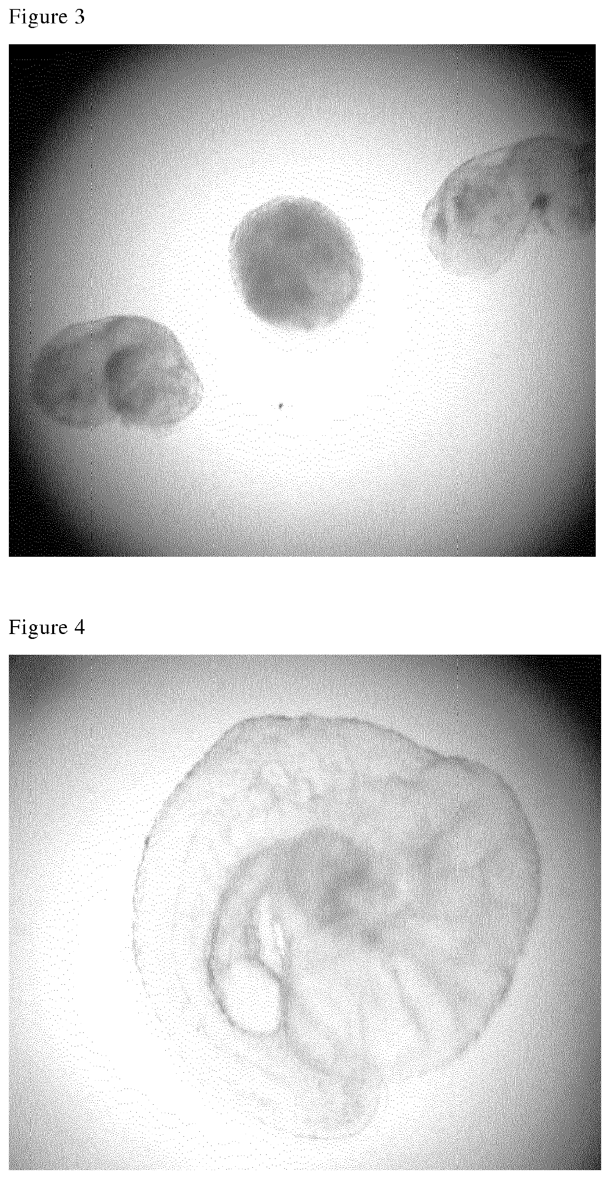 Method for removal of yolk