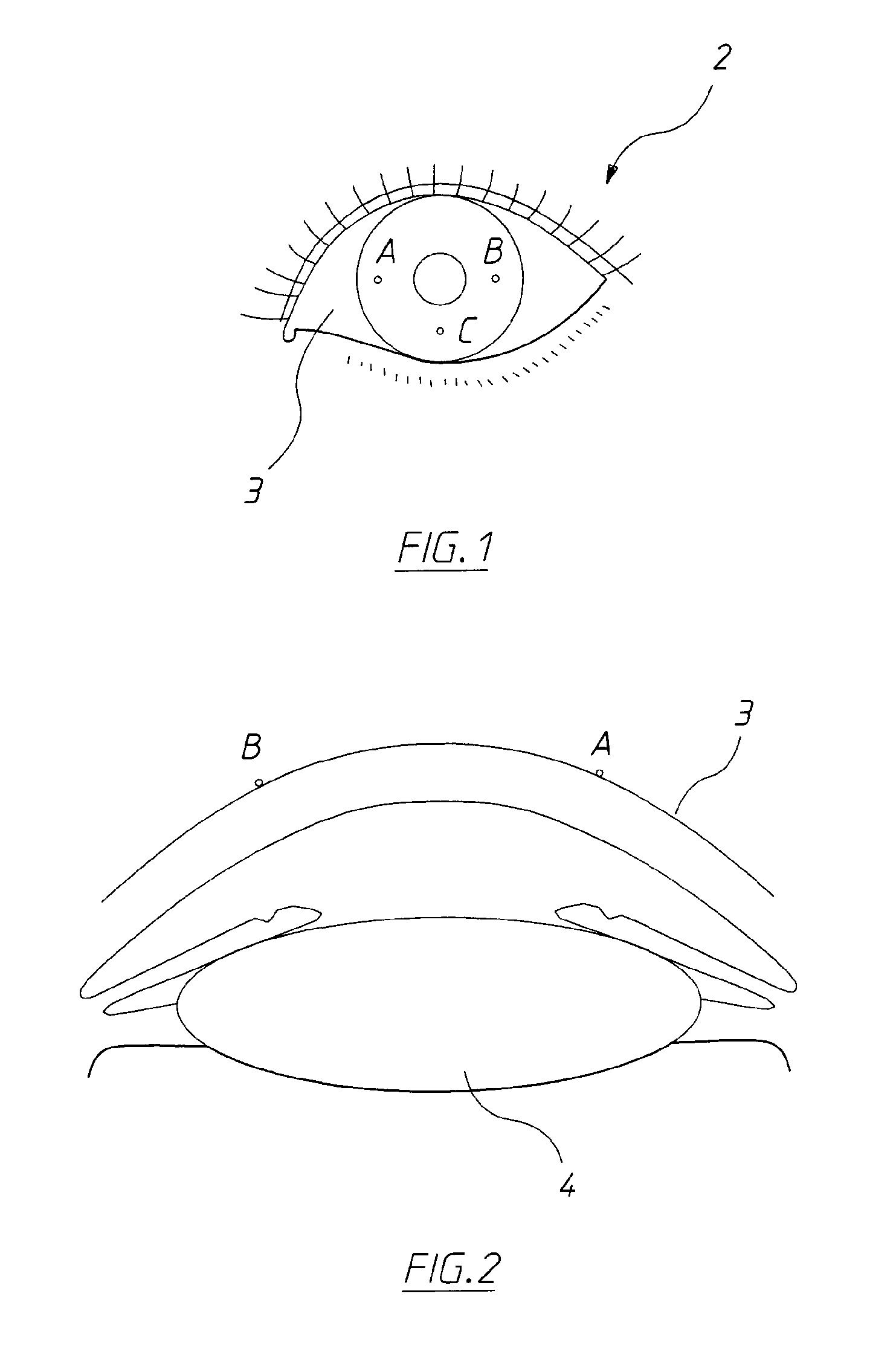 Ophthalmic marking device