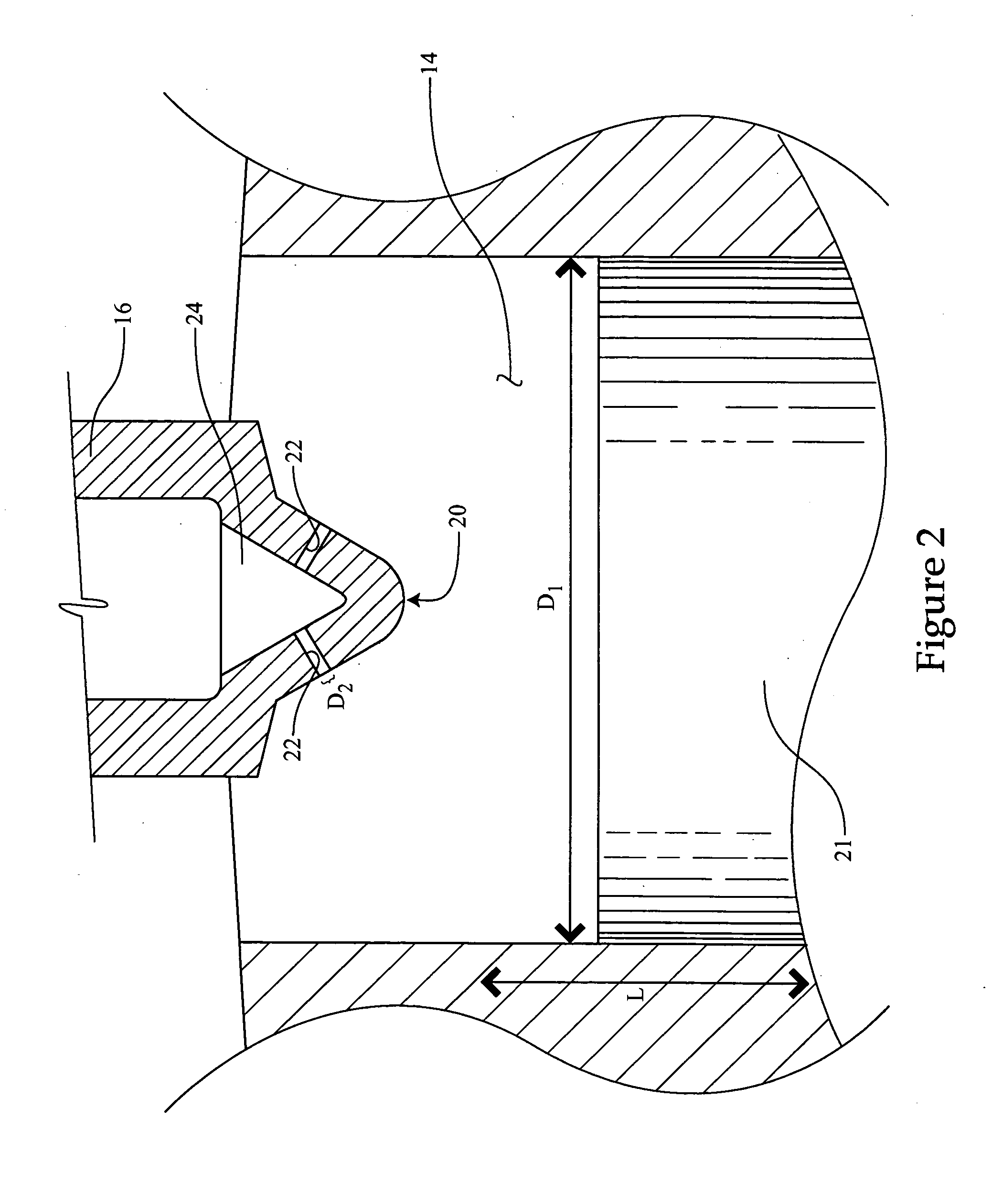 Internal combustion engine