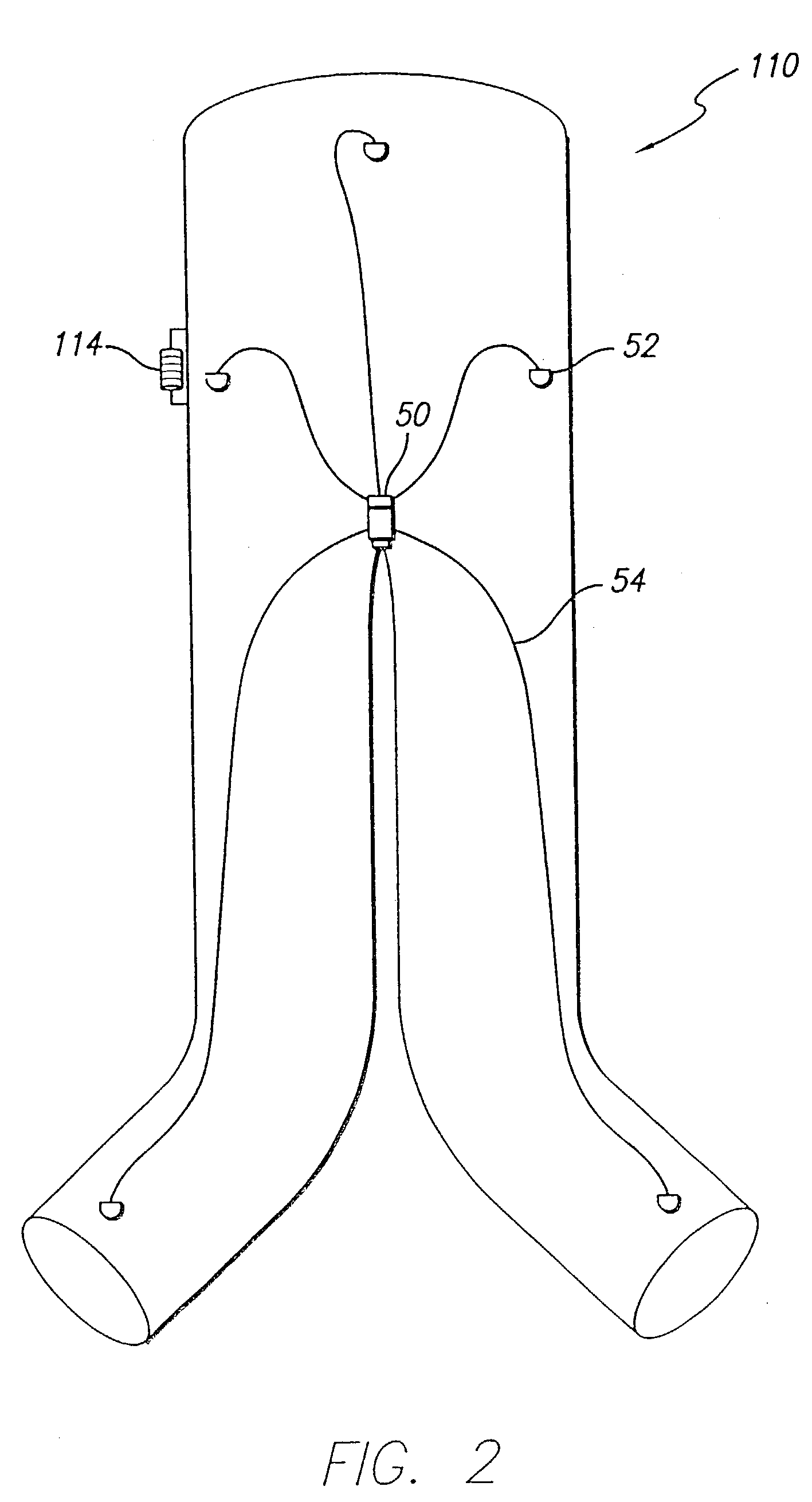 Endovascular graft with separable sensors