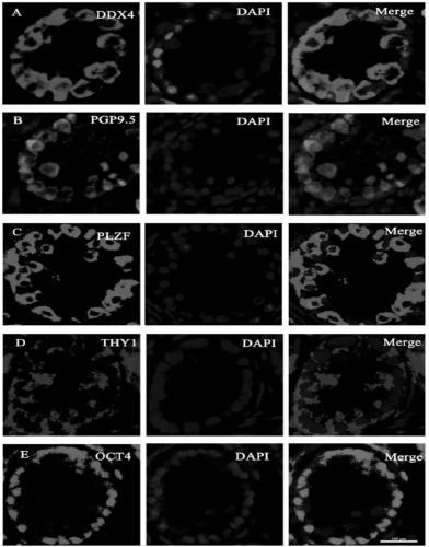 In-vitro culture and passage method of buffalo spermatogonial stem cell-like cells