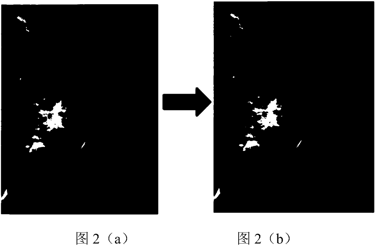 Method for automatically detecting position of nipple in molybdenum target image