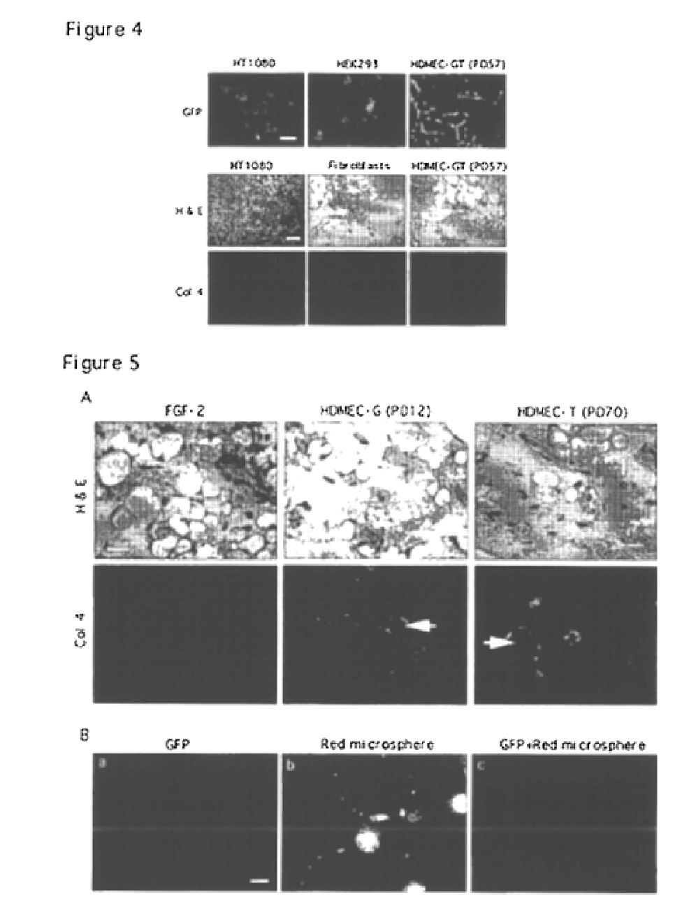 Vivo assay for anti angiogenic compounds