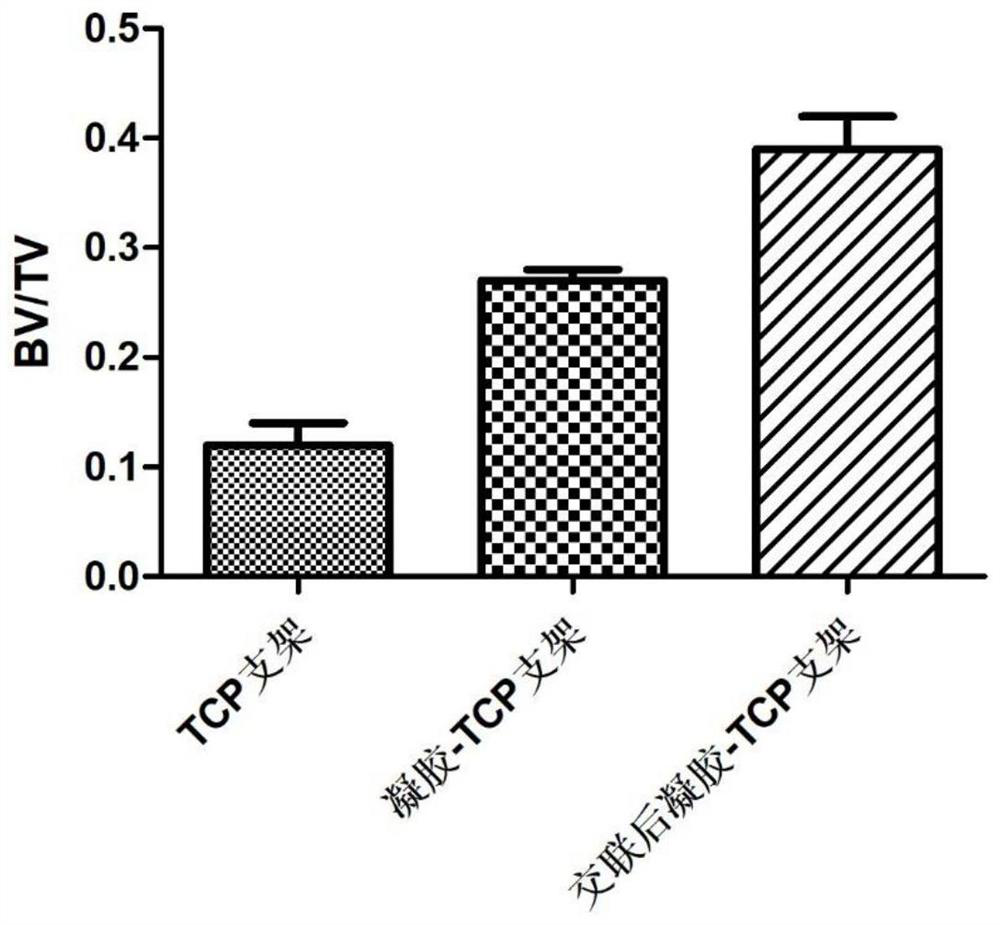 Bone replacement complex as well as preparation method and application thereof