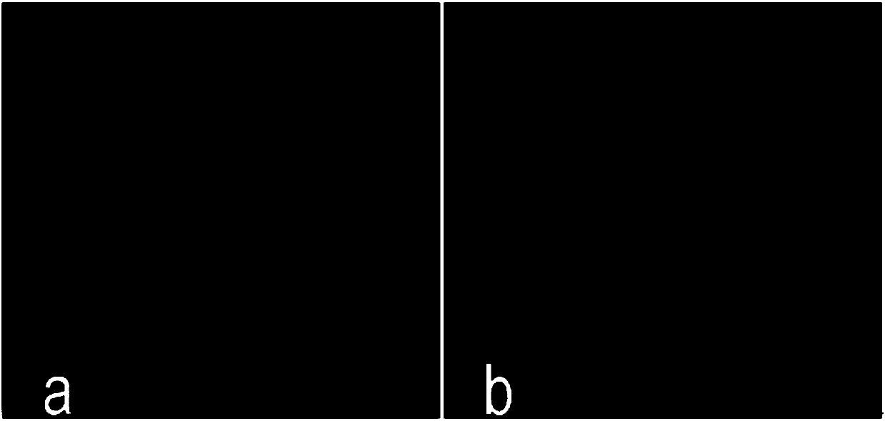 Cholesterol pyrophosphate, and preparation method and use thereof