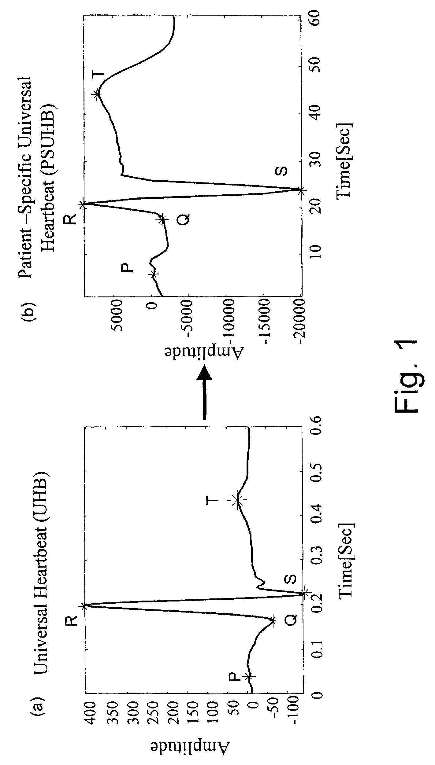 Self-adaptive system for the analysis of biomedical signals of a patient