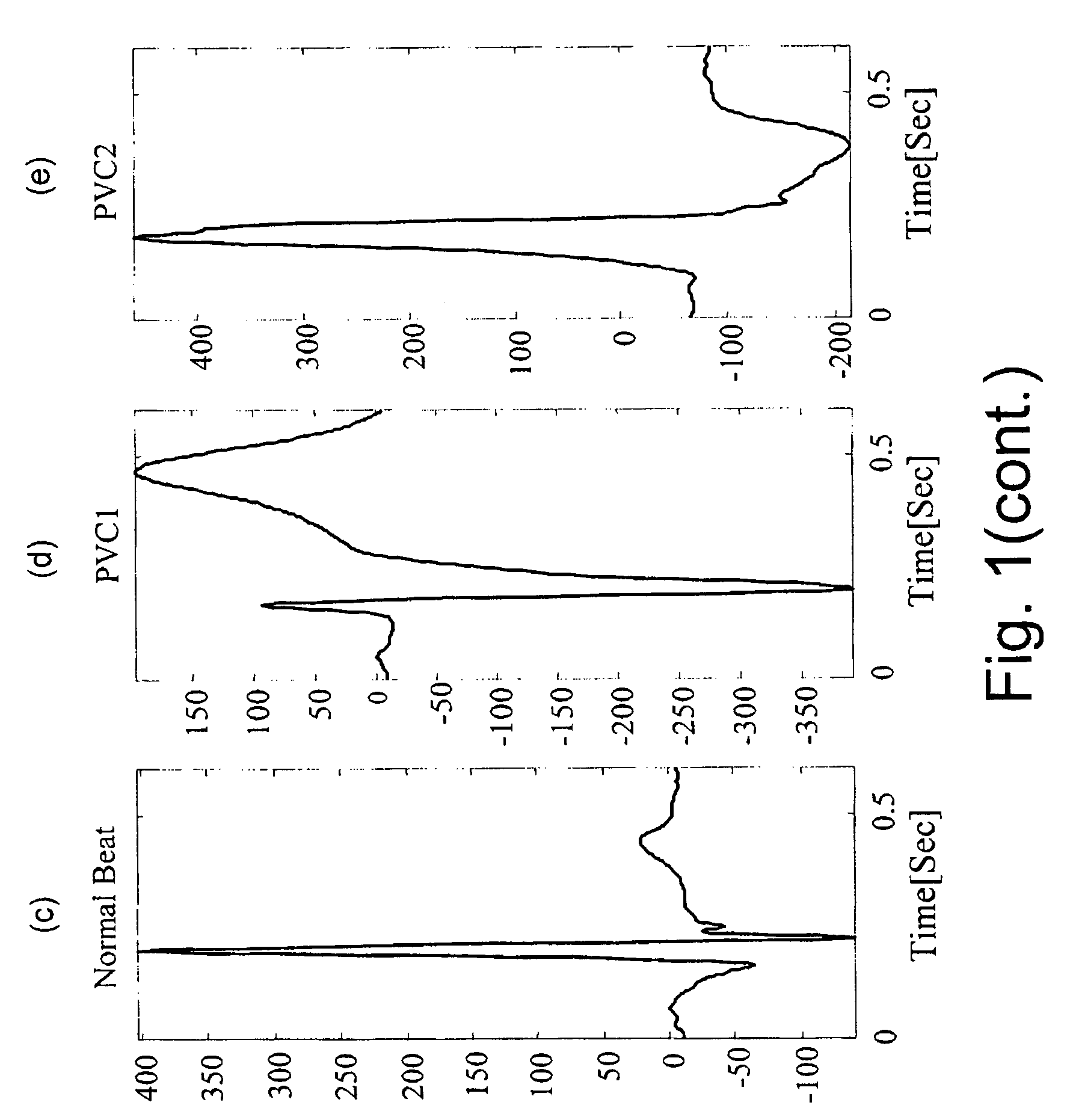 Self-adaptive system for the analysis of biomedical signals of a patient